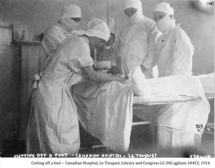 ::1914 cutting off a foot 18453v.jpg