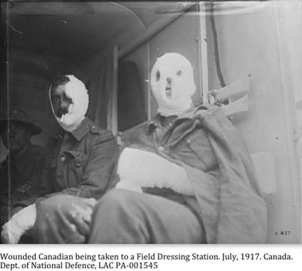 ::1917 07 00  wounded a001679-v8.jpg